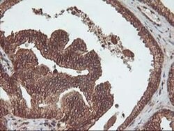 UBOX5 Monoclonal Antibody (OTI1C5), TrueMAB , OriGene 100 &mu;L; Unconjugated:Antibodies,