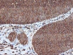 UBOX5 Monoclonal Antibody (OTI1C5), TrueMAB , OriGene 100 &mu;L; Unconjugated:Antibodies,
