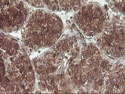 UBOX5 Monoclonal Antibody (OTI1C5), TrueMAB , OriGene 100 &mu;L; Unconjugated:Antibodies,