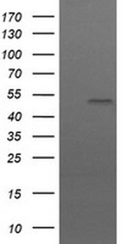 UBOX5 Monoclonal Antibody (OTI 7G1), TrueMAB , OriGene:Antibodies:Primary