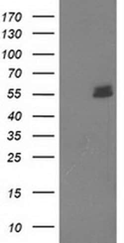 UBOX5 Monoclonal Antibody (OTI5G9), TrueMAB , OriGene:Antibodies:Primary