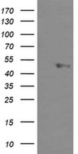 UBOX5 Monoclonal Antibody (OTI 4C1), TrueMAB , OriGene:Antibodies:Primary