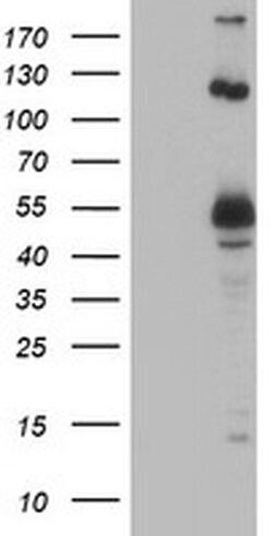 UBOX5 Monoclonal Antibody (OTI1C5), TrueMAB , OriGene:Antibodies:Primary
