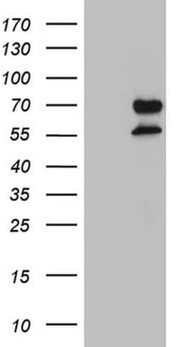 UBP1 Monoclonal Antibody (OTI9C7), TrueMAB , OriGene 100 &mu;L; Unconjugated:Antibodies,