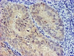 UBXN2B Monoclonal Antibody (OTI2E9), TrueMAB , OriGene:Antibodies:Primary