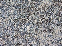 UBXN2B Monoclonal Antibody (OTI1F7), TrueMAB , OriGene 100 &mu;L; Unconjugated:Antibodies,