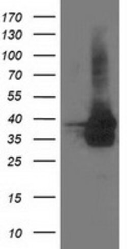 UBXN2B Mouse anti-Canine, Human, Clone: OTI2E8, lyophilized, TrueMAB 100