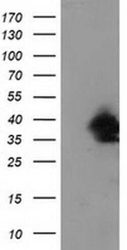 UBXN2B Mouse anti-Canine, Human, Clone: OTI3H8, liquid, TrueMAB 30 &mu;L;