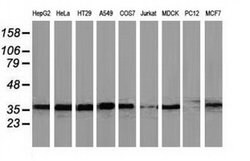 UBXN2B Mouse anti-Canine, Human, Clone: OTI3H8, liquid, TrueMAB 30 &mu;L;
