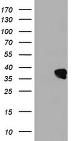 UBXN2B Monoclonal Antibody (OTI2E9), TrueMAB , OriGene 30 &mu;L; Unconjugated:Antibodies,