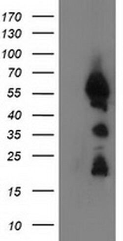 UBXN2B Monoclonal Antibody (OTI1F7), TrueMAB , OriGene 100 &mu;L; Unconjugated:Antibodies,