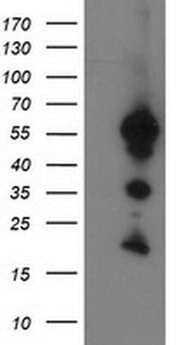 UBXN2B Monoclonal Antibody (OTI1G8), TrueMAB , OriGene:Antibodies:Primary