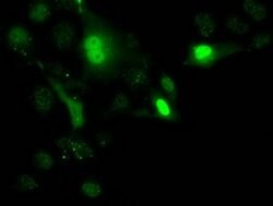 UCK1 Monoclonal Antibody (OTI4C2), TrueMAB , OriGene 100 &mu;L; Unconjugated:Antibodies,