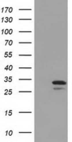 UCK1 Mouse anti-Human, Clone: OTI4C2, lyophilized, TrueMAB 100 &mu;g; Unconjugated:Antibodies,