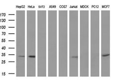 UCK1 Mouse anti-Human, Clone: OTI4C2, lyophilized, TrueMAB 100 &mu;g; Unconjugated:Antibodies,