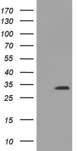 UCK1 Mouse anti-Human, Clone: OTI4H1, lyophilized, TrueMAB 100 &mu;g; Unconjugated:Antibodies,
