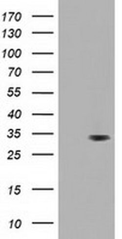 UCK1 Monoclonal Antibody (OTI7E11), TrueMAB , OriGene:Antibodies:Primary