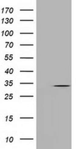 UCK1 Monoclonal Antibody (OTI1A12), TrueMAB , OriGene 30 &mu;L; Unconjugated:Antibodies,