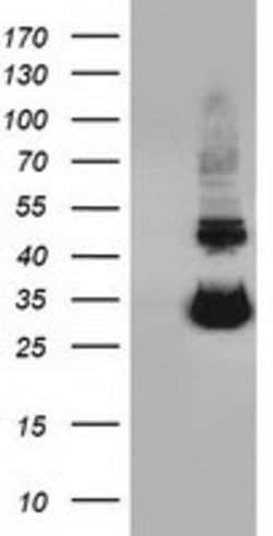 UCK1 Mouse anti-Human, Clone: OTI5E9, lyophilized, TrueMAB 100 &mu;g; Unconjugated:Antibodies,