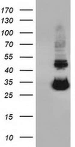 UCK1 Mouse anti-Human, Clone: OTI5E9, TrueMAB , Origene 30 &mu;L; Unconjugated:Antibodies,