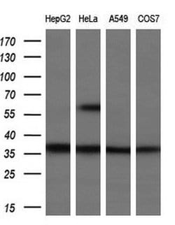 UCK1 Mouse anti-Human, Clone: OTI5E9, lyophilized, TrueMAB 100 &mu;g; Unconjugated:Antibodies,