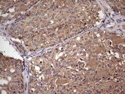 UFD1L Monoclonal Antibody (OTI8G6), TrueMAB , OriGene 100 &mu;L; Unconjugated:Antibodies,