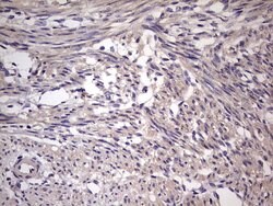 UFD1L Monoclonal Antibody (OTI8G6), TrueMAB , OriGene 100 &mu;L; Unconjugated:Antibodies,