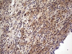 UFD1L Monoclonal Antibody (OTI8G6), TrueMAB , OriGene 100 &mu;L; Unconjugated:Antibodies,