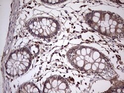UFD1L Monoclonal Antibody (OTI8G6), TrueMAB , OriGene 100 &mu;L; Unconjugated:Antibodies,