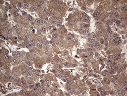 UFD1L Monoclonal Antibody (OTI8G6), TrueMAB , OriGene 100 &mu;L; Unconjugated:Antibodies,