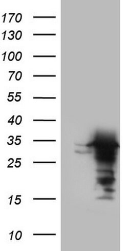 UFD1L Monoclonal Antibody (OTI3B4), TrueMAB , OriGene 100 &mu;L; Unconjugated:Antibodies,