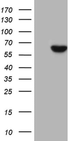 UGDH Monoclonal Antibody (OTI2C11), TrueMAB , OriGene 100 &mu;L; Unconjugated:Antibodies,
