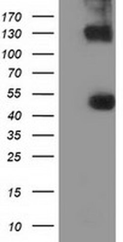UHMK1 Monoclonal Antibody (OTI2H4), TrueMAB , OriGene 30 &mu;L; Unconjugated:Antibodies,