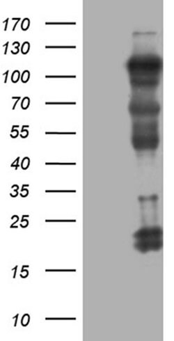 UHRF2 Monoclonal Antibody (OTI4E10), TrueMAB , OriGene 100 &mu;L; Unconjugated:Antibodies,