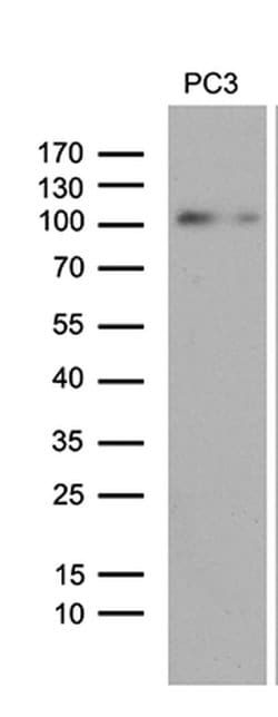 UHRF2 Monoclonal Antibody (OTI1H2), TrueMAB , OriGene:Antibodies:Primary