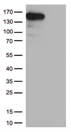 CPS1 Mouse anti-Mouse, Rat, Clone: UMAB282, Origene 100 &mu;g | Buy Online | Origene Technologies | Fisher Scientific