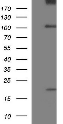 UNC13D Monoclonal Antibody (OTI1F4), TrueMAB , OriGene 100 &mu;L; Unconjugated:Antibodies,