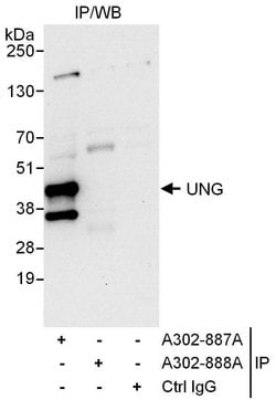 UNG Rabbit anti-Human, Polyclonal, Bethyl Laboratories 100 &mu;L; Unconjugated:Antibodies,
