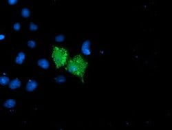 UNG Mouse anti-Human, Clone: OTI1G1, lyophilized, TrueMAB 100 &mu;g; Unconjugated:Antibodies,