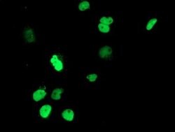UNG Monoclonal Antibody (OTI1B6), TrueMAB , OriGene 100 &mu;L; Unconjugated:Antibodies,