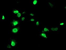 UNG Monoclonal Antibody (OTI2C12), TrueMAB , OriGene 100 &mu;L; Unconjugated:Antibodies,