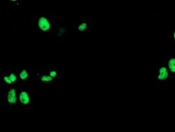 UNG Mouse anti-Human, Clone: OTI2F3, lyophilized, TrueMAB 100 &mu;g; Unconjugated:Antibodies,
