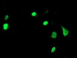UNG Monoclonal Antibody (OTI2B5), TrueMAB , OriGene:Antibodies:Primary