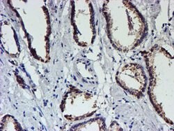 UNG Mouse anti-Human, Clone: OTI1G1, lyophilized, TrueMAB 100 &mu;g; Unconjugated:Antibodies,