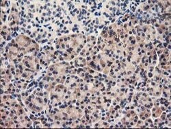 UNG Monoclonal Antibody (OTI1B6), TrueMAB , OriGene:Antibodies:Primary