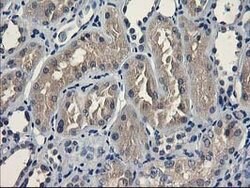 UNG Mouse anti-Human, Clone: OTI1B6, lyophilized, TrueMAB 100 &mu;g; Unconjugated:Antibodies,