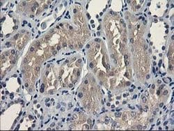 UNG Monoclonal Antibody (OTI1B6), TrueMAB , OriGene:Antibodies:Primary