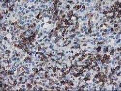 UNG Mouse anti-Human, Clone: OTI2F8, lyophilized, TrueMAB 100 &mu;g; Unconjugated:Antibodies,