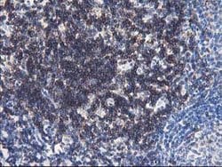 UNG Mouse anti-Human, Clone: OTI2F8, lyophilized, TrueMAB 100 &mu;g; Unconjugated:Antibodies,