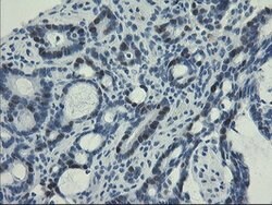 UNG Mouse anti-Human, Clone: OTI2F8, lyophilized, TrueMAB 100 &mu;g; Unconjugated:Antibodies,